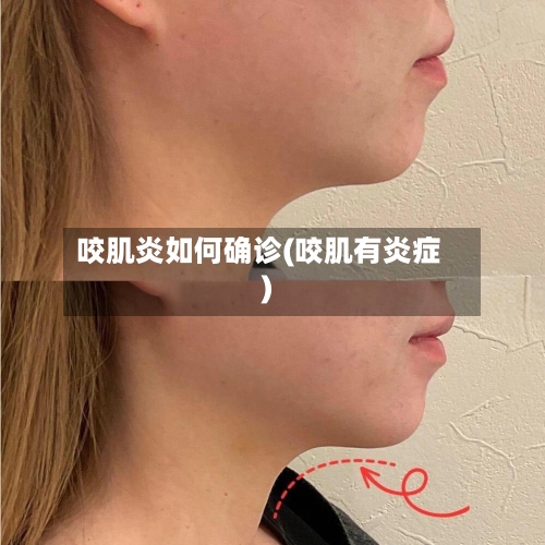 咬肌炎如何确诊(咬肌有炎症)