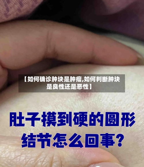 【如何确诊肿块是肿瘤,如何判断肿块是良性还是恶性】