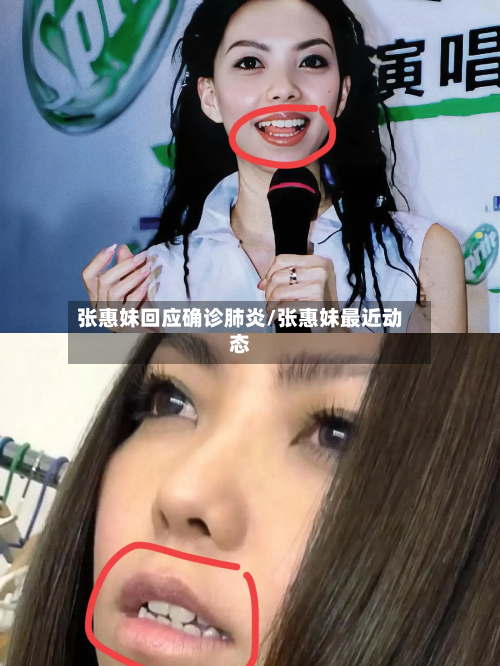 张惠妹回应确诊肺炎/张惠妹最近动态-第2张图片