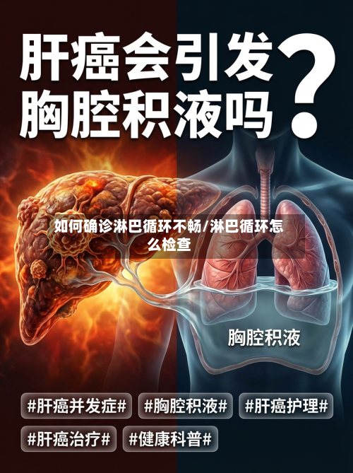 如何确诊淋巴循环不畅/淋巴循环怎么检查