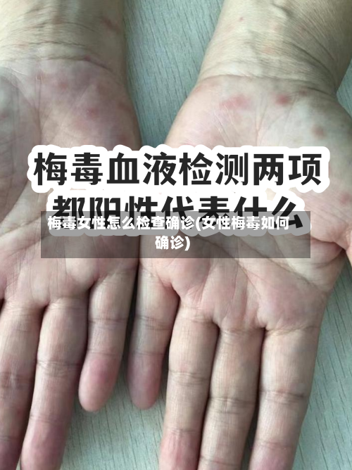 梅毒女性怎么检查确诊(女性梅毒如何确诊)-第2张图片