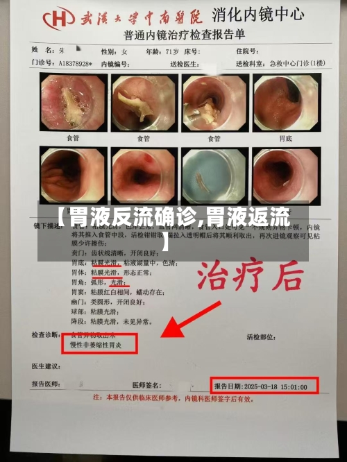 【胃液反流确诊,胃液返流】