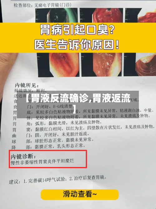 【胃液反流确诊,胃液返流】-第2张图片