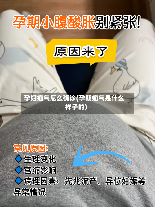 孕妇疝气怎么确诊(孕期疝气是什么样子的)-第2张图片