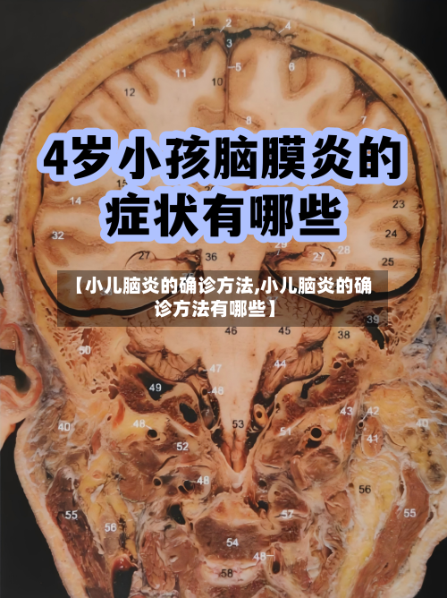 【小儿脑炎的确诊方法,小儿脑炎的确诊方法有哪些】-第3张图片