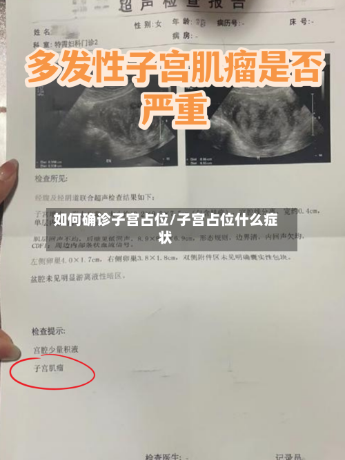 如何确诊子宫占位/子宫占位什么症状