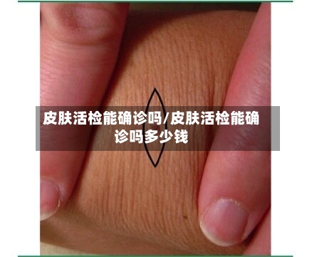 皮肤活检能确诊吗/皮肤活检能确诊吗多少钱