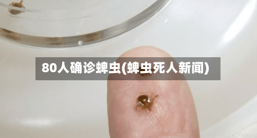 80人确诊蜱虫(蜱虫死人新闻)