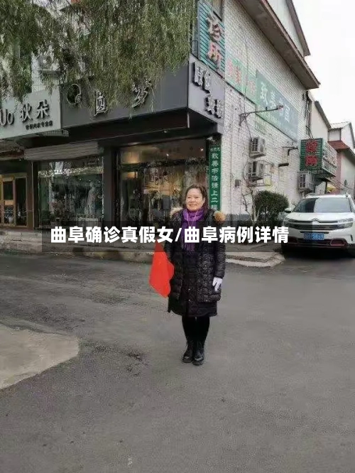 曲阜确诊真假女/曲阜病例详情