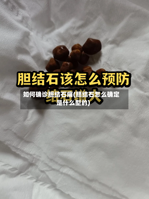 如何确诊胆结石痛(胆结石怎么确定是什么型的)-第3张图片
