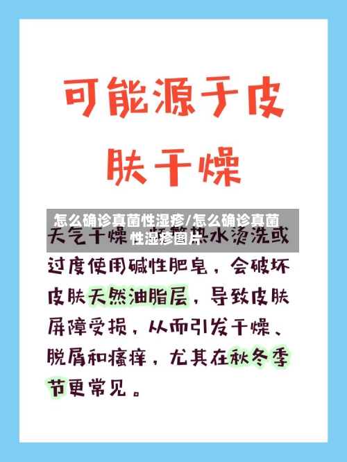 怎么确诊真菌性湿疹/怎么确诊真菌性湿疹图片-第2张图片