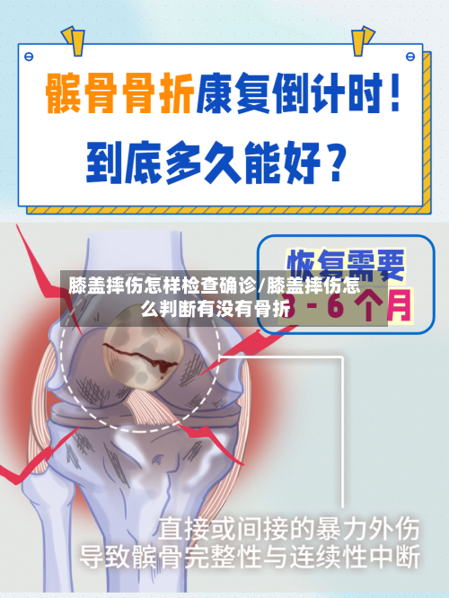 膝盖摔伤怎样检查确诊/膝盖摔伤怎么判断有没有骨折-第2张图片