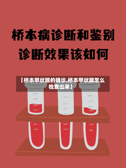 【桥本甲状腺的确诊,桥本甲状腺怎么检查出来】-第2张图片