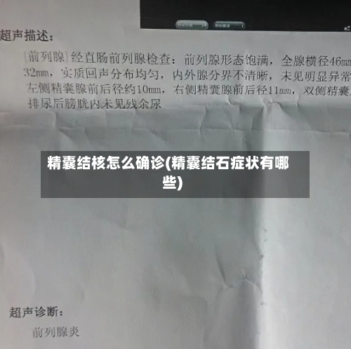 精囊结核怎么确诊(精囊结石症状有哪些)-第2张图片
