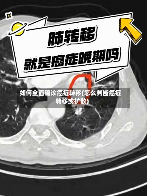 如何全面确诊癌症转移(怎么判断癌症转移或扩散)-第3张图片