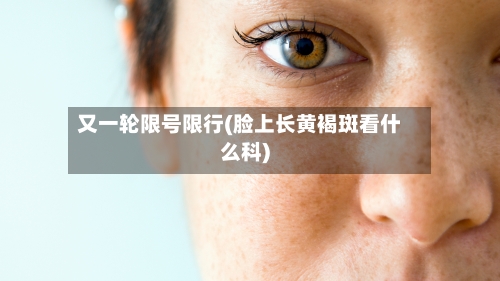 又一轮限号限行(脸上长黄褐斑看什么科)