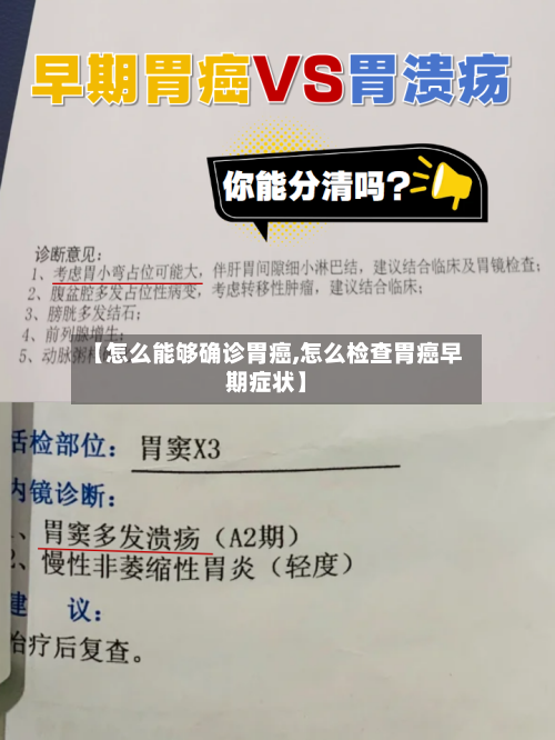 【怎么能够确诊胃癌,怎么检查胃癌早期症状】