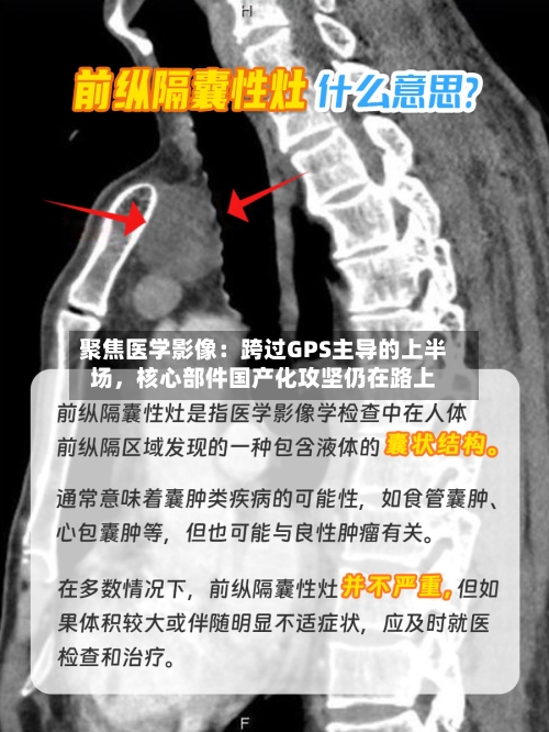 聚焦医学影像：跨过GPS主导的上半场	，核心部件国产化攻坚仍在路上-第2张图片