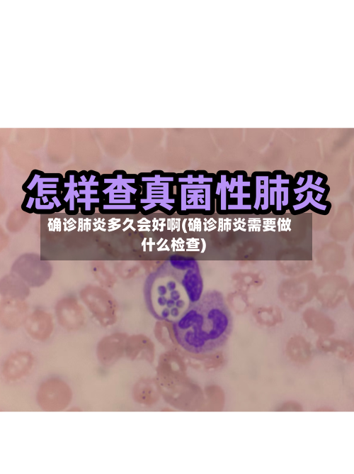 确诊肺炎多久会好啊(确诊肺炎需要做什么检查)-第3张图片