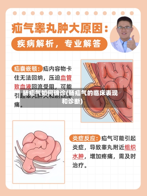 肠疝气如何确诊(肠疝气的临床表现和诊断)