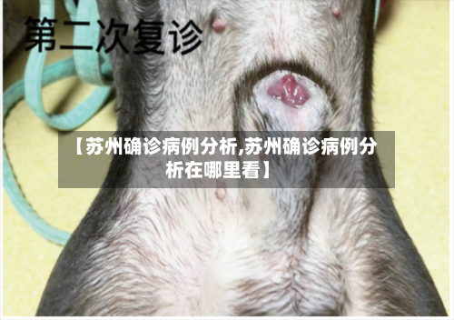 【苏州确诊病例分析,苏州确诊病例分析在哪里看】-第2张图片