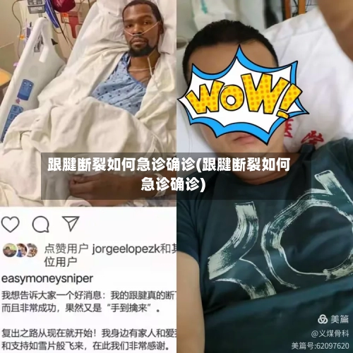 跟腱断裂如何急诊确诊(跟腱断裂如何急诊确诊)-第2张图片