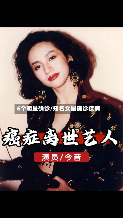 6个明星确诊/知名女星确诊疾病-第2张图片