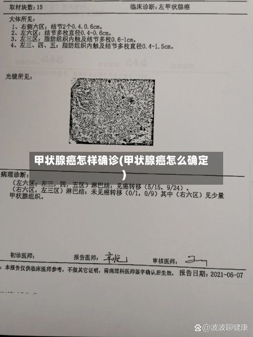 甲状腺癌怎样确诊(甲状腺癌怎么确定)-第2张图片
