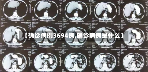 【确诊病例3694例,确诊病例是什么】-第2张图片