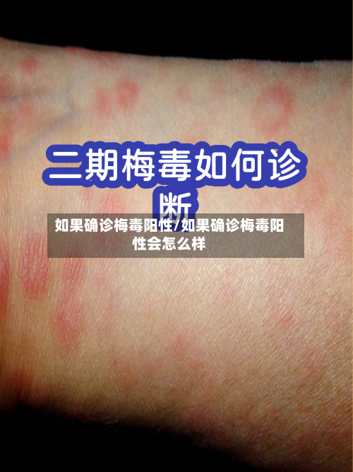 如果确诊梅毒阳性/如果确诊梅毒阳性会怎么样