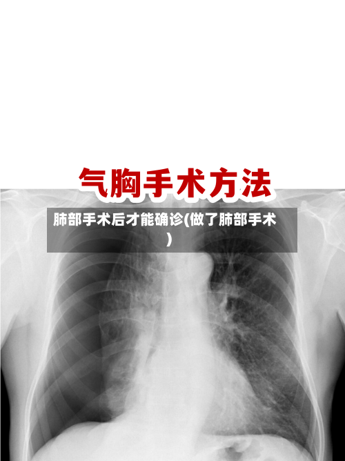 肺部手术后才能确诊(做了肺部手术)