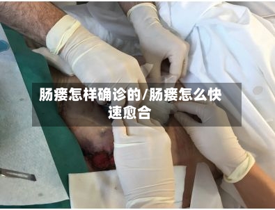 肠瘘怎样确诊的/肠瘘怎么快速愈合