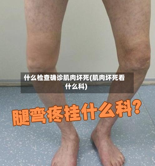 什么检查确诊肌肉坏死(肌肉坏死看什么科)